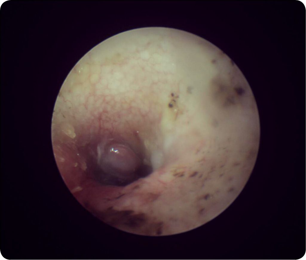 MEDYCYNA_KOTOW_25_Anna_Maryniuk_POLIPEKTOMIA_Z_UZYCIEM_PETLI_ENDOSKOPOWEJ_RYC_1 polipa