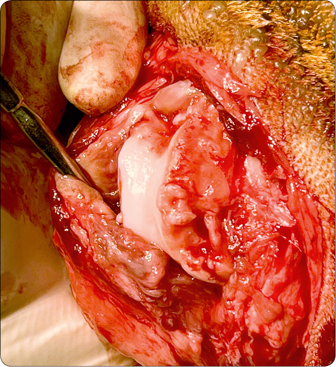 WWP_1-2_26_chirurgia_ortopedia_Michal_Stelmaszyk_ZASTOSOWANIE_IMPLANTU_TGR_PRZY_NAWYKOWYM_ZWICHNIECIU_RZEPKI_RYC_1